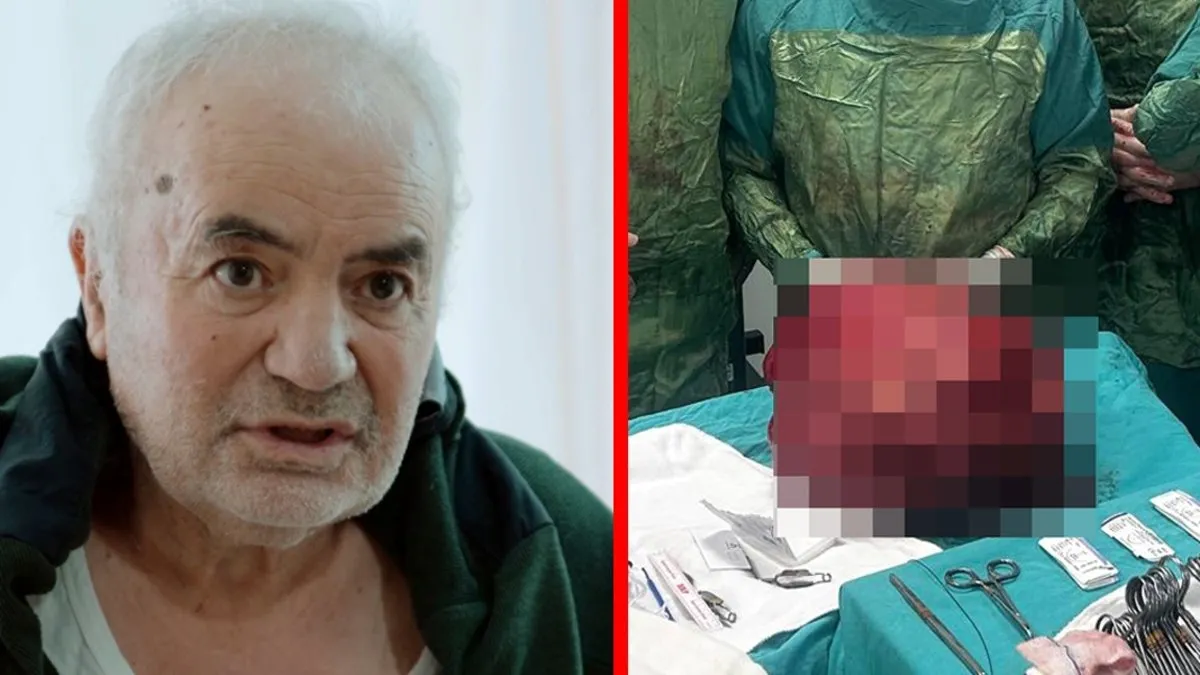 Yıllarca böyle yaşamış: Karnından çıktı! Tam 13 kilo!